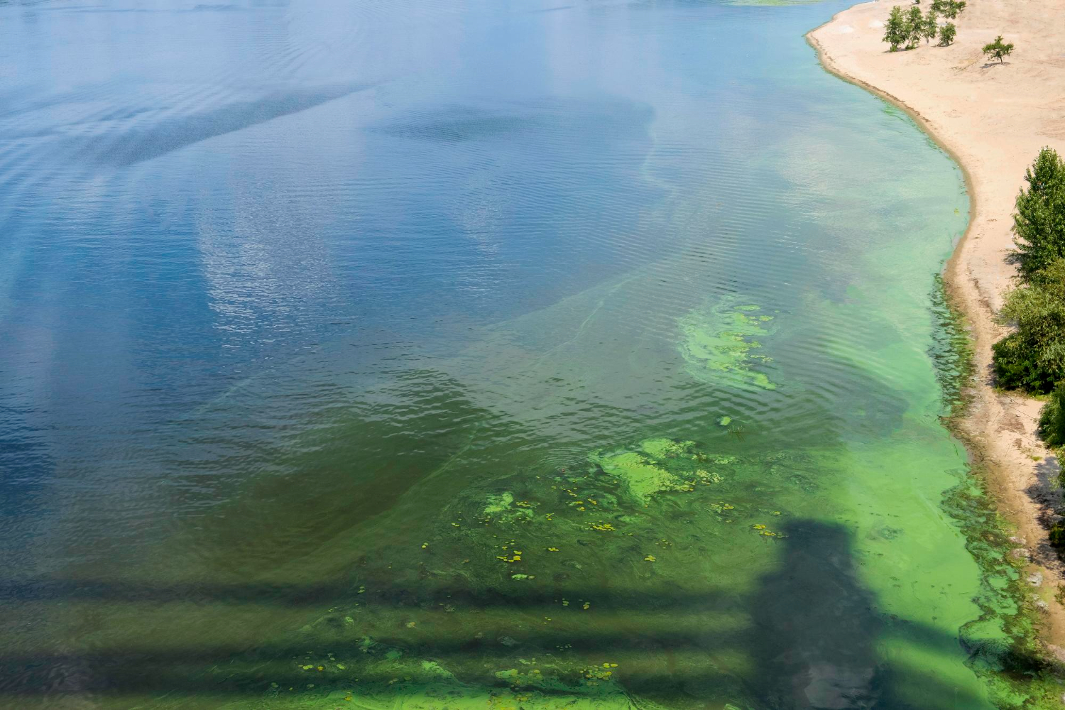 Toxic Water When Community Ponds Can Become Deadly